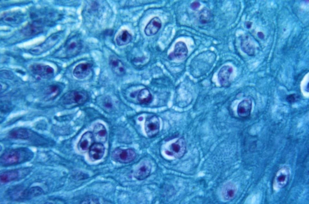 Microscopic View of Monkeypox Virus.